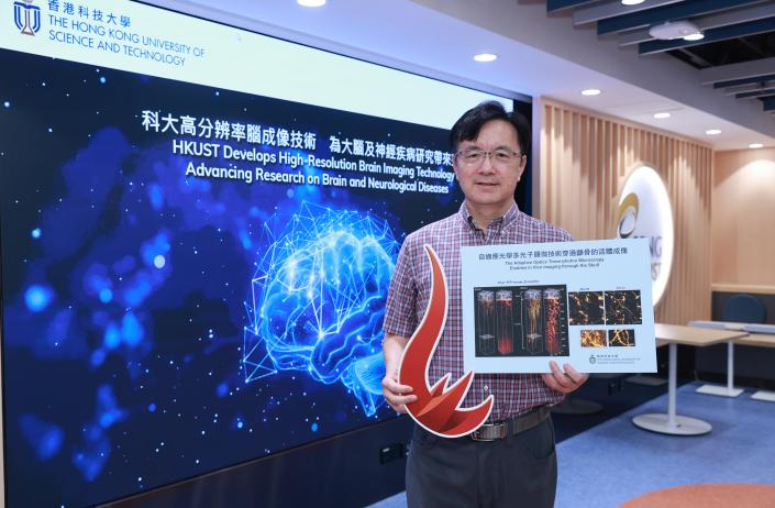 A research team led by Prof. QU Jianan, Professor of the HKUST Department of Electronic and Computer Engineering of the School of Engineering, has introduced a groundbreaking technique that can capture high-resolution images of the awake mice brain in a near non-invasive manner. The advancement promises deeper insights into human brain function in both healthy and diseased conditions.